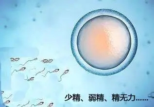 郑州专业治疗不孕不育医院哪家好?精子少是怎么回事?